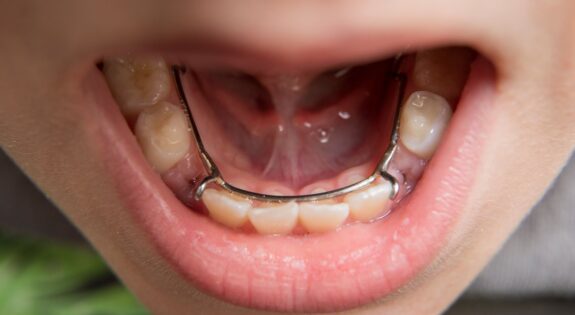 pediatric dentist near me