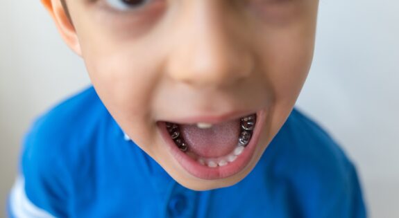 pediatric dentist near me